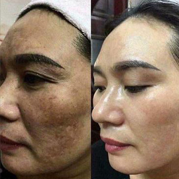 Feedback khách hàng có hiệu quả khi sử dụng mỹ phẩm Adonai Beauty Việt Nam 02 - Adonai Viet Nam